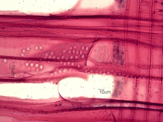 Aesculus glabra, Radial-Section